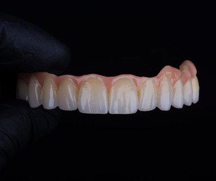 Dentist carefully holding a denture