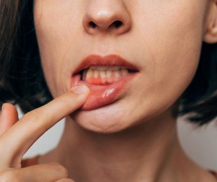 Lady shows inflamed gums