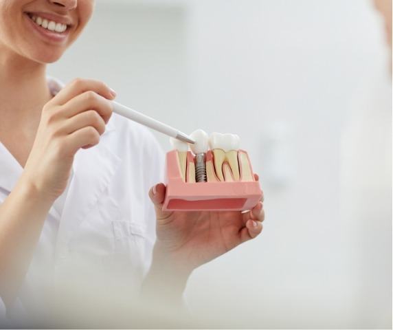 Dentist pointing to a model of a dental implant in the jaw