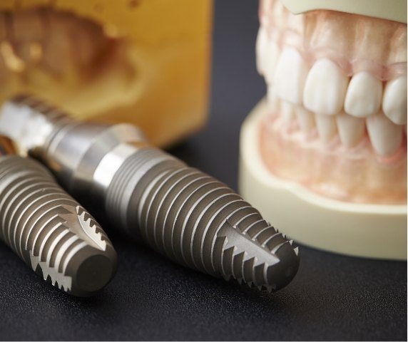 Two dental implants in Vero Beach on table next to denture