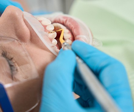 A patient undergoing a scaling and root planing treatment
