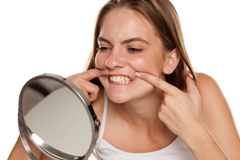 Patient pulling lips to look at smile in mirror after DIY teeth whitening